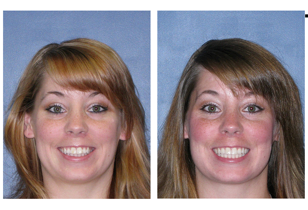 Smile Doctors Dentistry   Implants