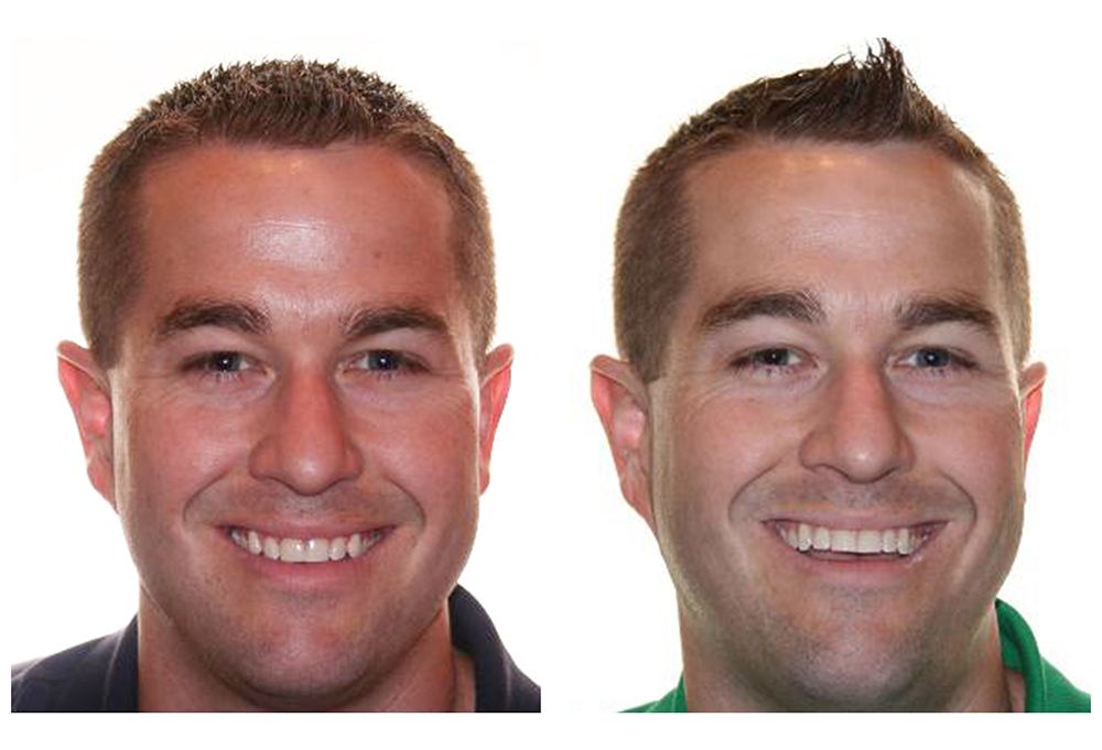 Smile Doctors Dentistry   Implants