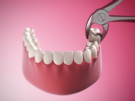 Smile Doctors Dentistry   Implants