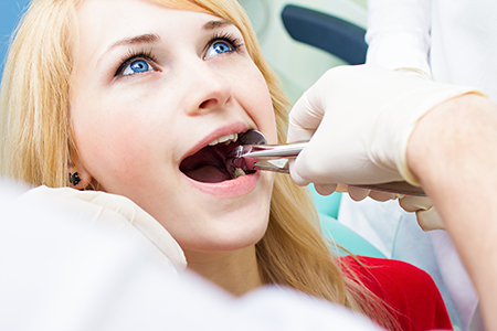 Smile Doctors Dentistry   Implants